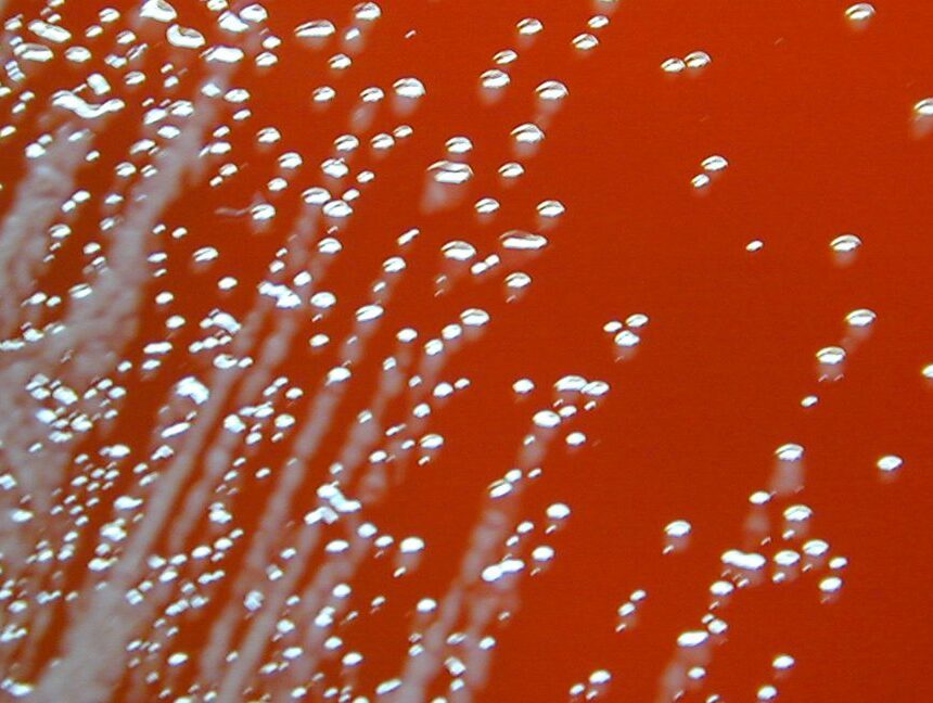 GettyImages_Burkholderia_CROPPED-1152x648.jpeg Deux hommes sont tombés gravement malades l’année dernière ; leurs infections sont liées à des décès survenus dans les années 80